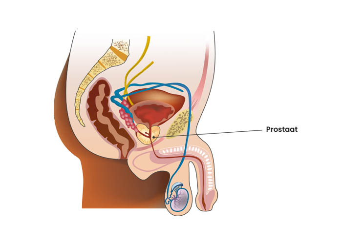 13 praktische vragen over prostaatproblemen bij mannen - FysioPelvis